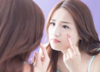 Jerawat Bukan Hanya Masalah Kecantikan, ada Dampak Fisik dan Psikologis