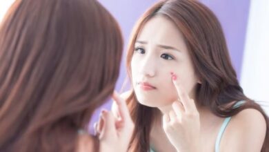 Jerawat Bukan Hanya Masalah Kecantikan, ada Dampak Fisik dan Psikologis