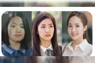 Melihat Transformasi Park Min Young Setelah Oplas...