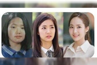 Melihat Transformasi Park Min Young Setelah Oplas...