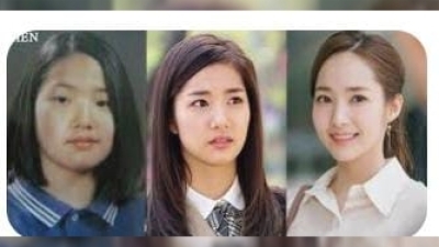 Melihat Transformasi Park Min Young Setelah Oplas...