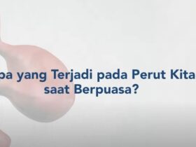 Mitos dan Fakta? Puasa Bermanfaat untuk Sistem Pencernaan, Ini Kata Dokter!