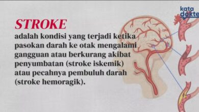 Mengenal Stroke Penyebab, Gejala, dan Pencegahannya